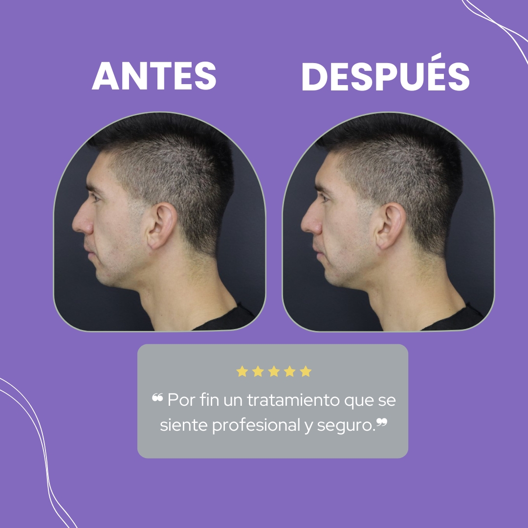 Descripción de la imagen 1