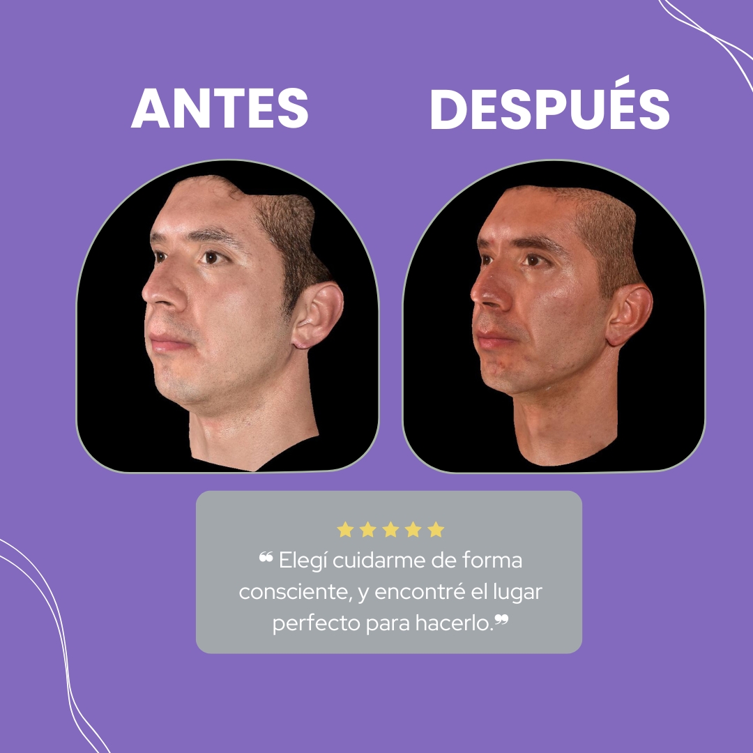 Descripción de la imagen 2