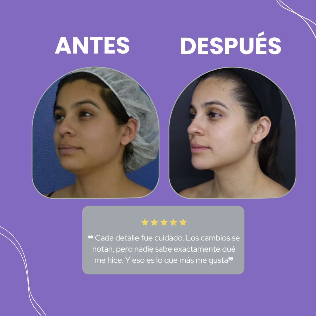 Descripción de la imagen 3
