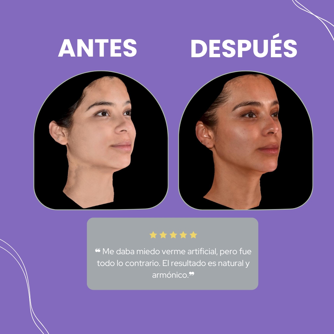 Descripción de la imagen 4
