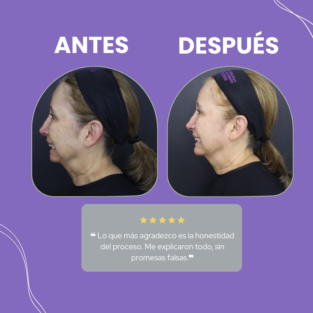 Descripción de la imagen 5