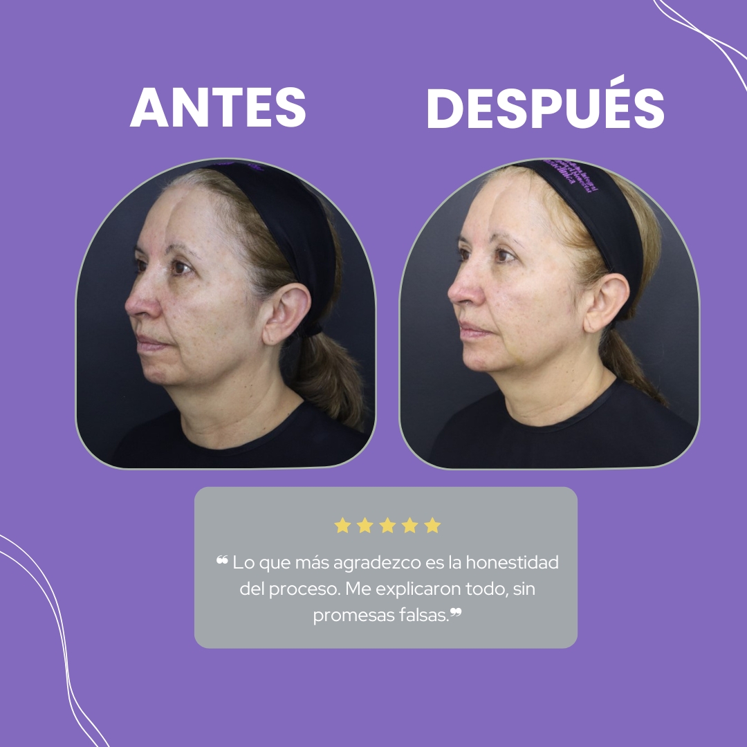 Descripción de la imagen 6