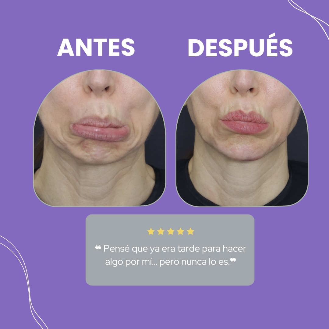 Descripción de la imagen 7